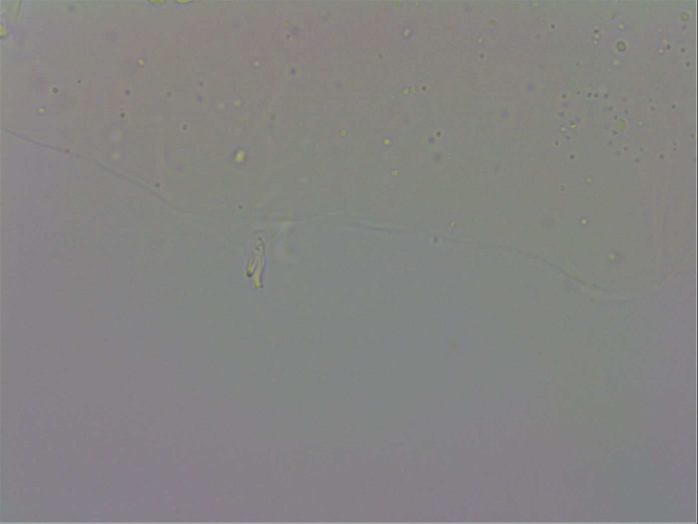 Mesobiotus coronatus image