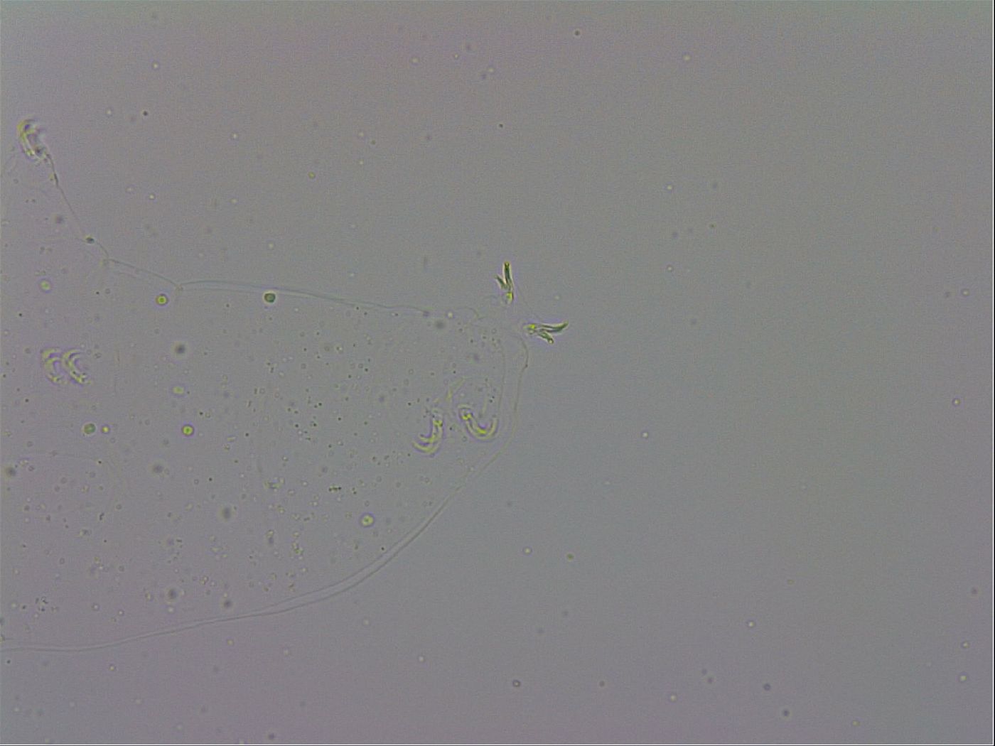 Mesobiotus coronatus image