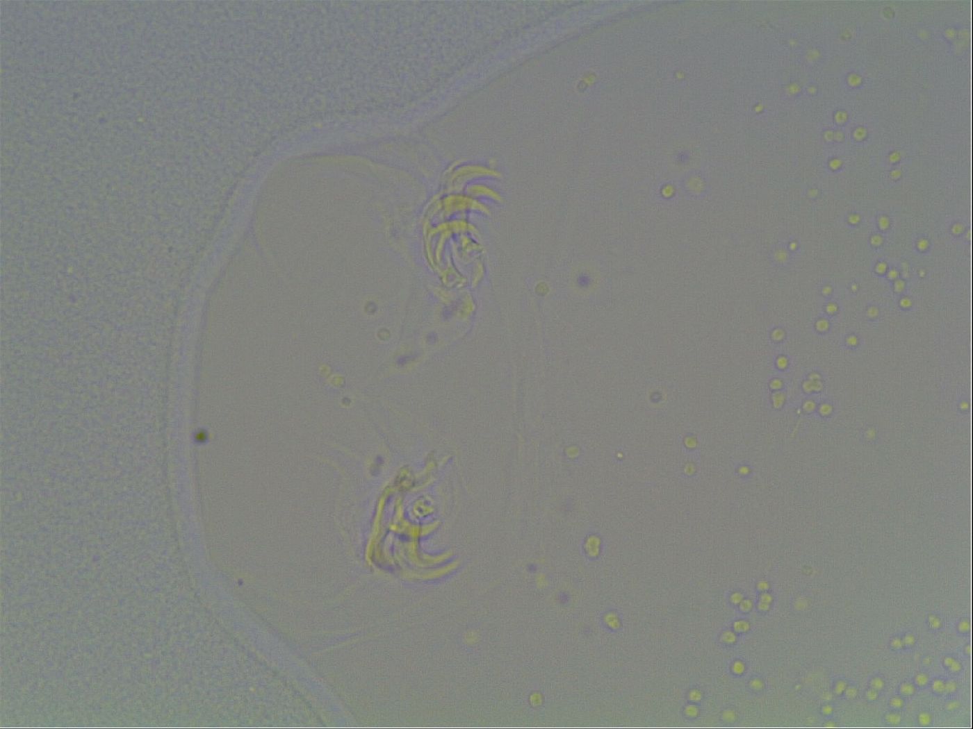 Mesobiotus coronatus image