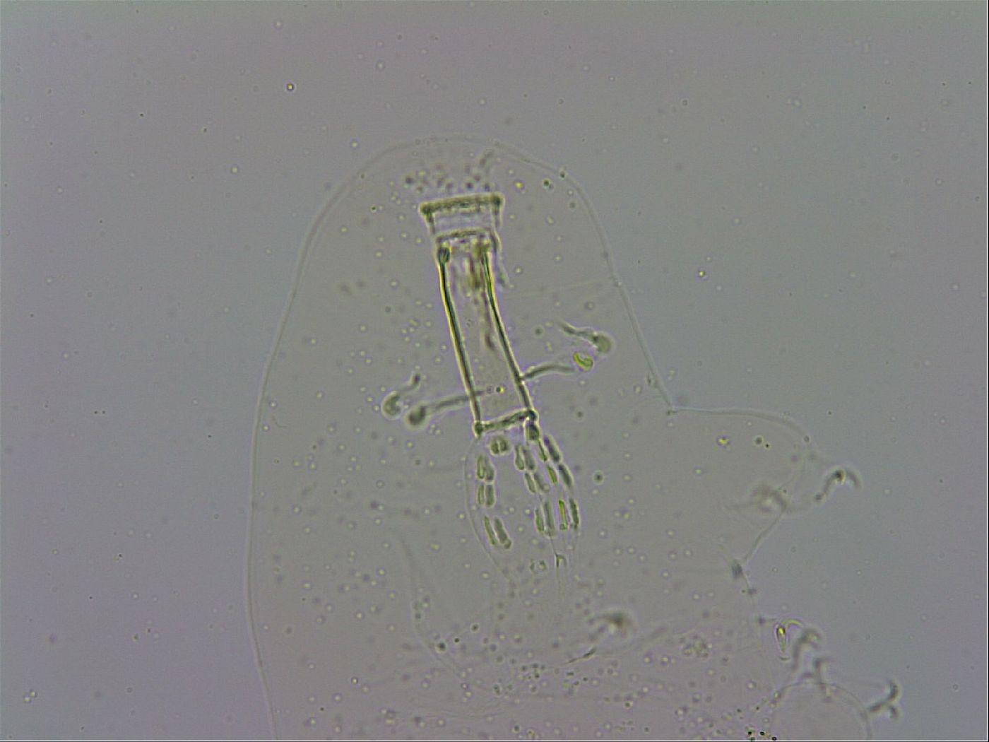 Mesobiotus coronatus image