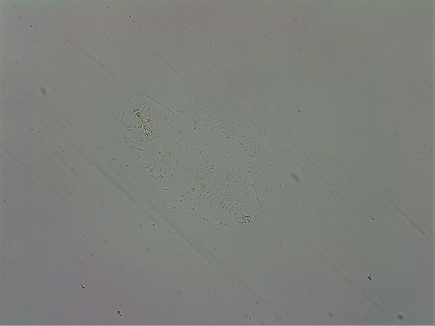 Mesobiotus coronatus image