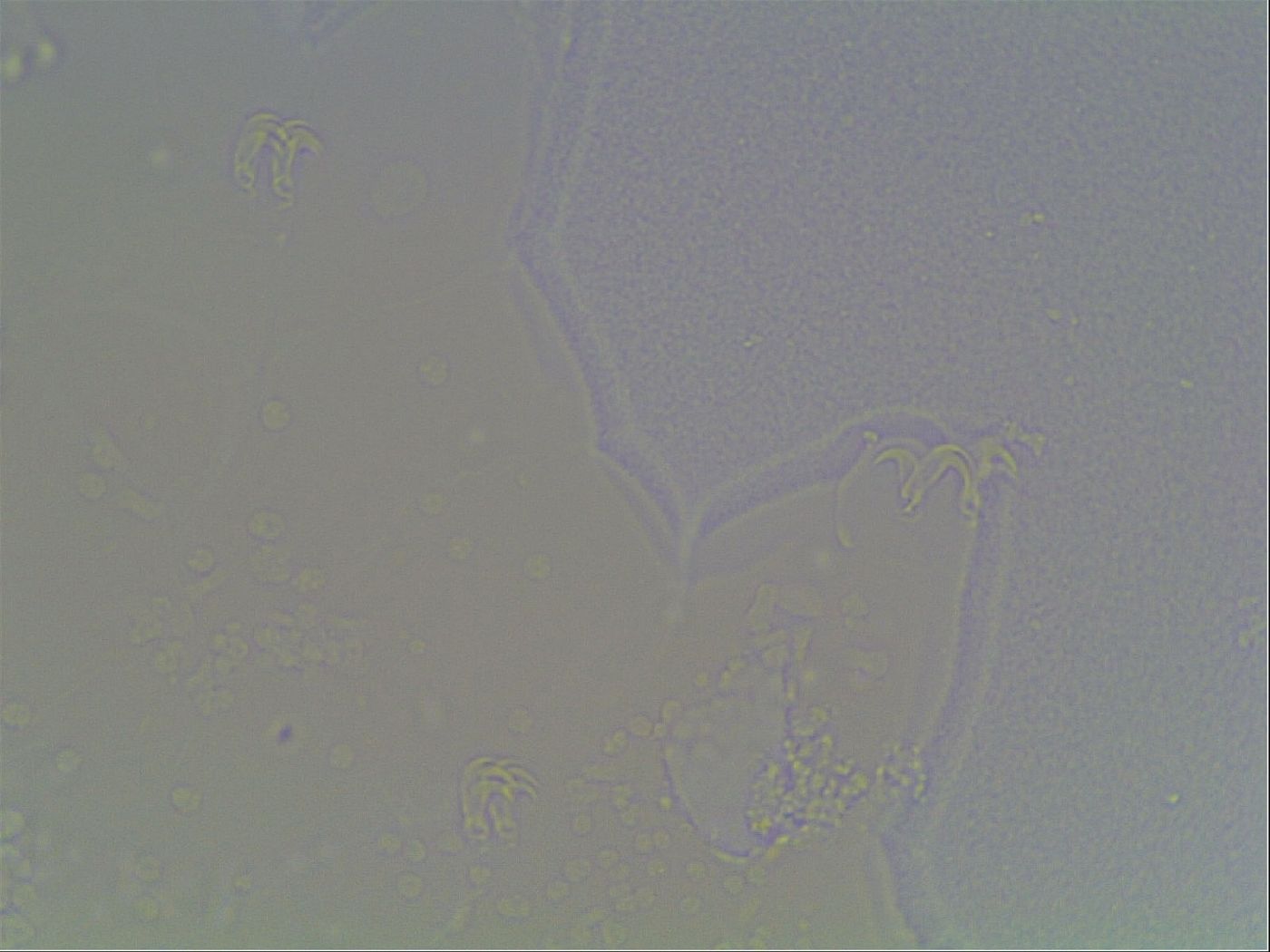 Mesobiotus coronatus image