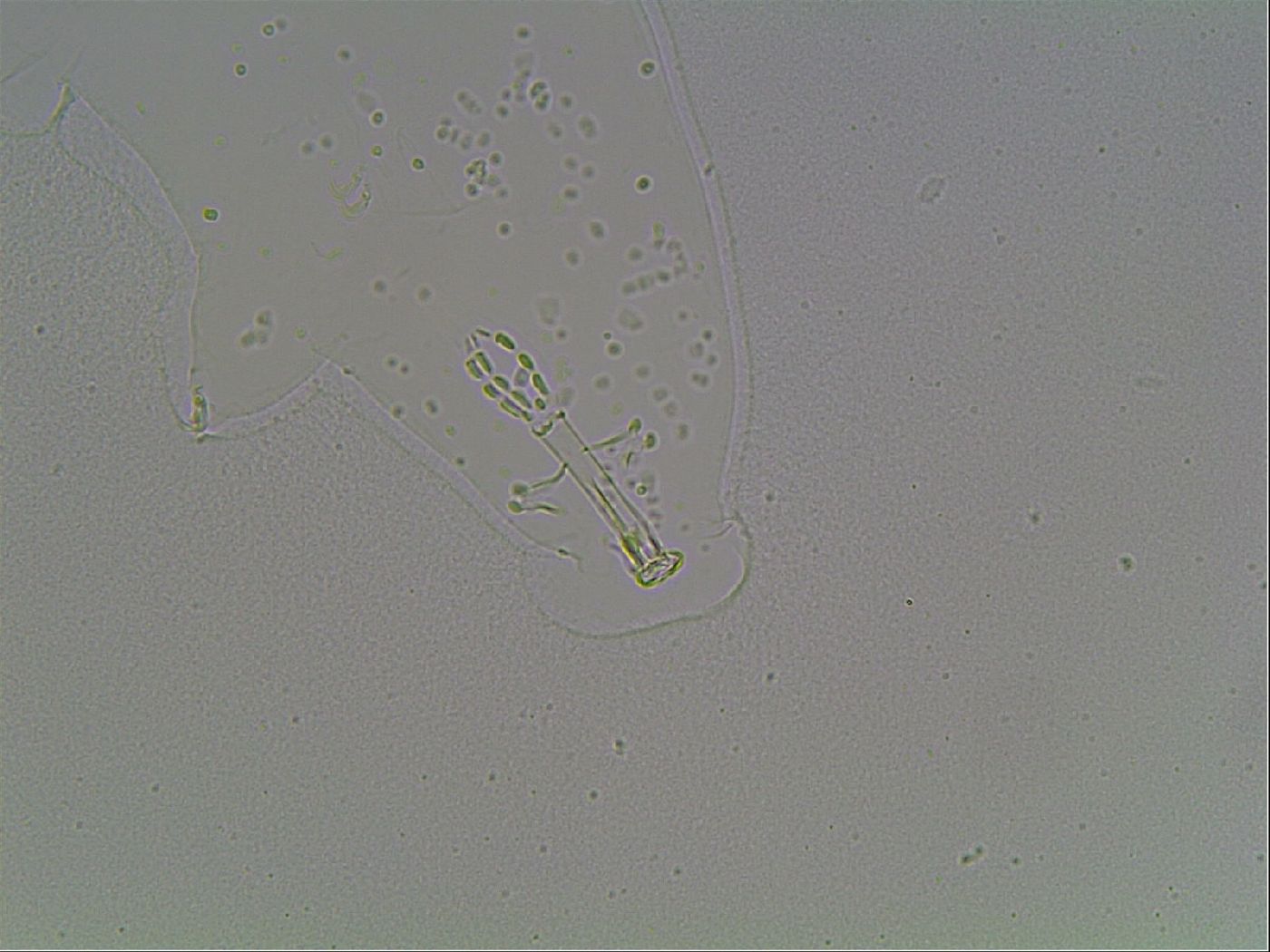 Mesobiotus coronatus image