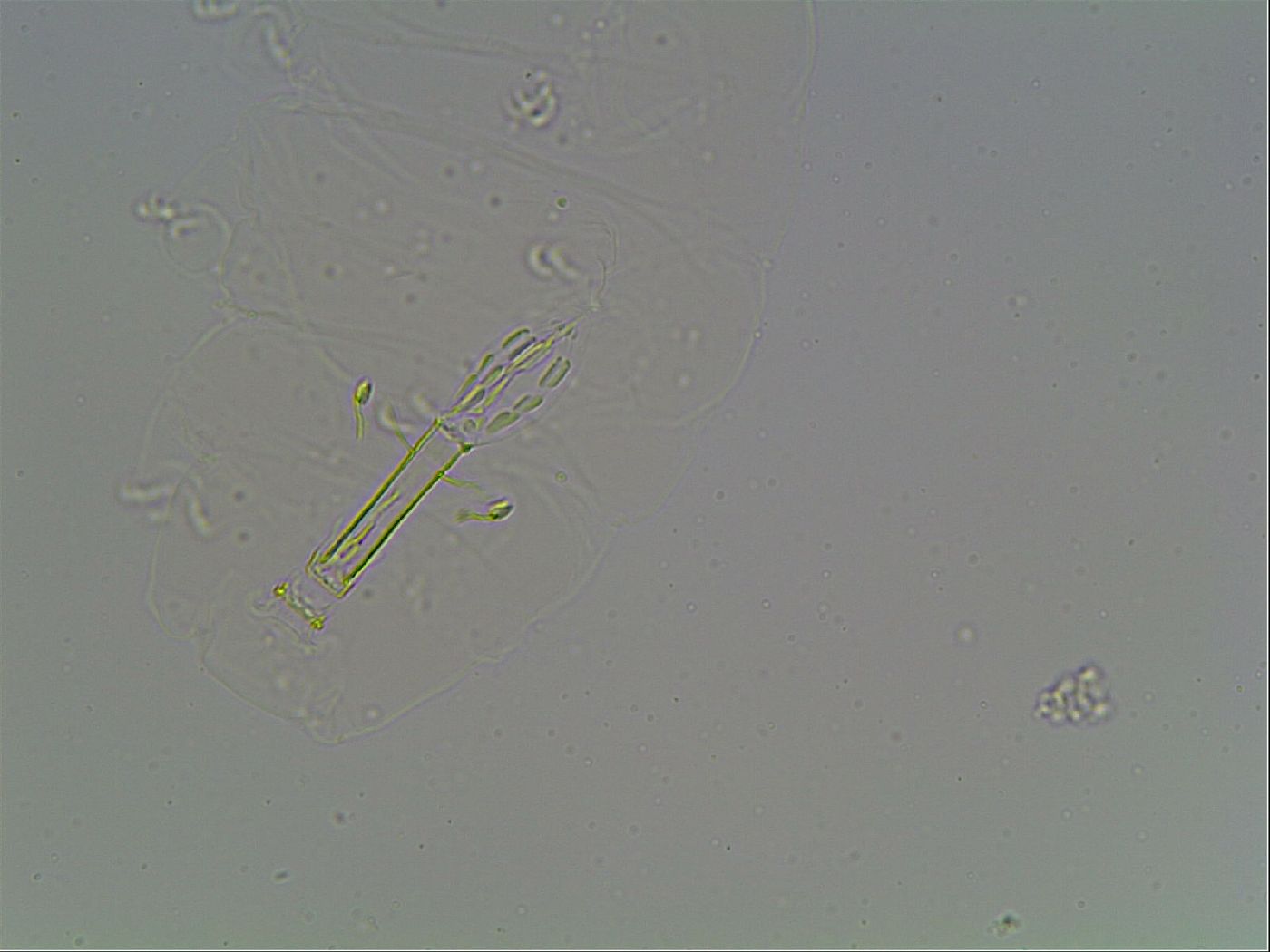Mesobiotus coronatus image