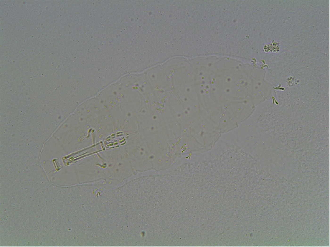 Mesobiotus coronatus image