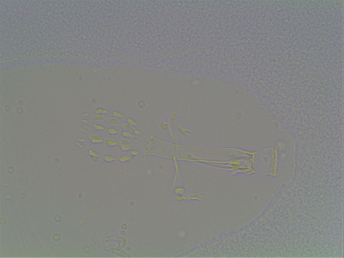 Mesobiotus coronatus image