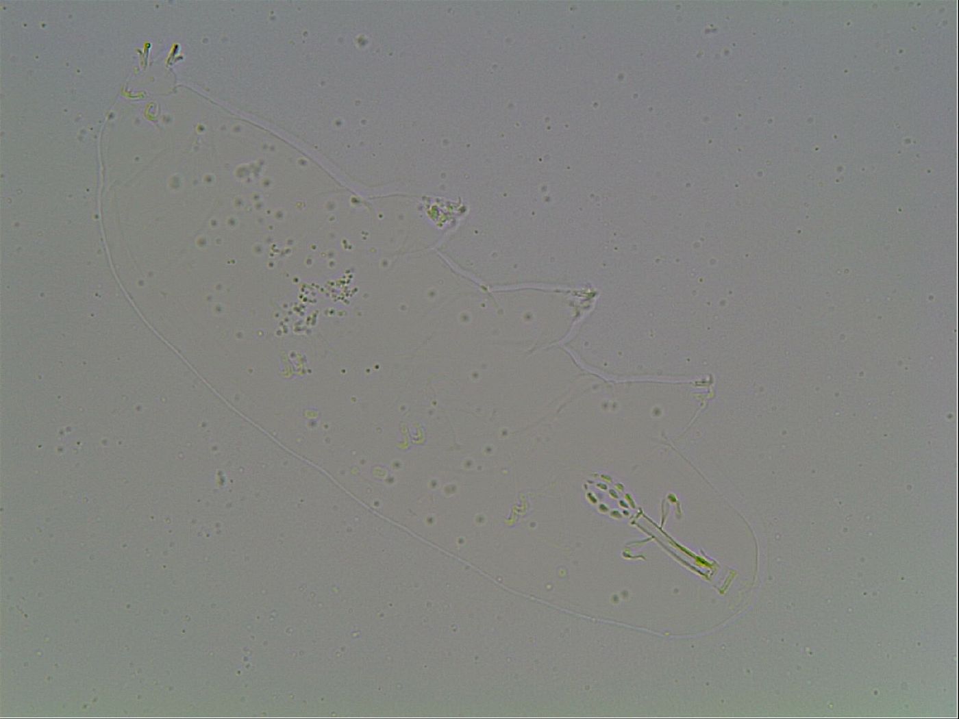 Mesobiotus coronatus image