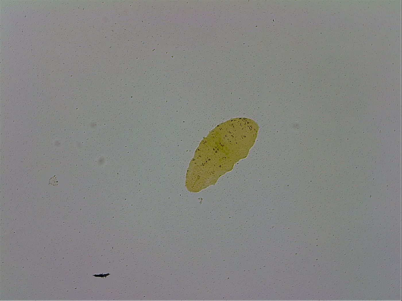Macrobiotus hufelandi hufelandi image