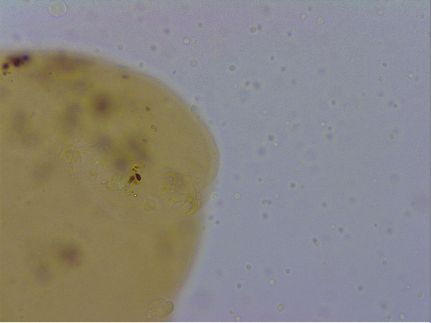 Macrobiotus hufelandi hufelandi image