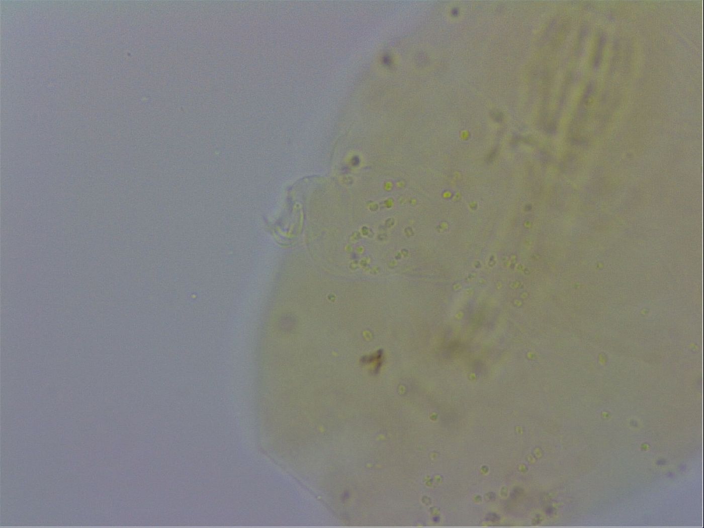 Macrobiotus hibiscus image