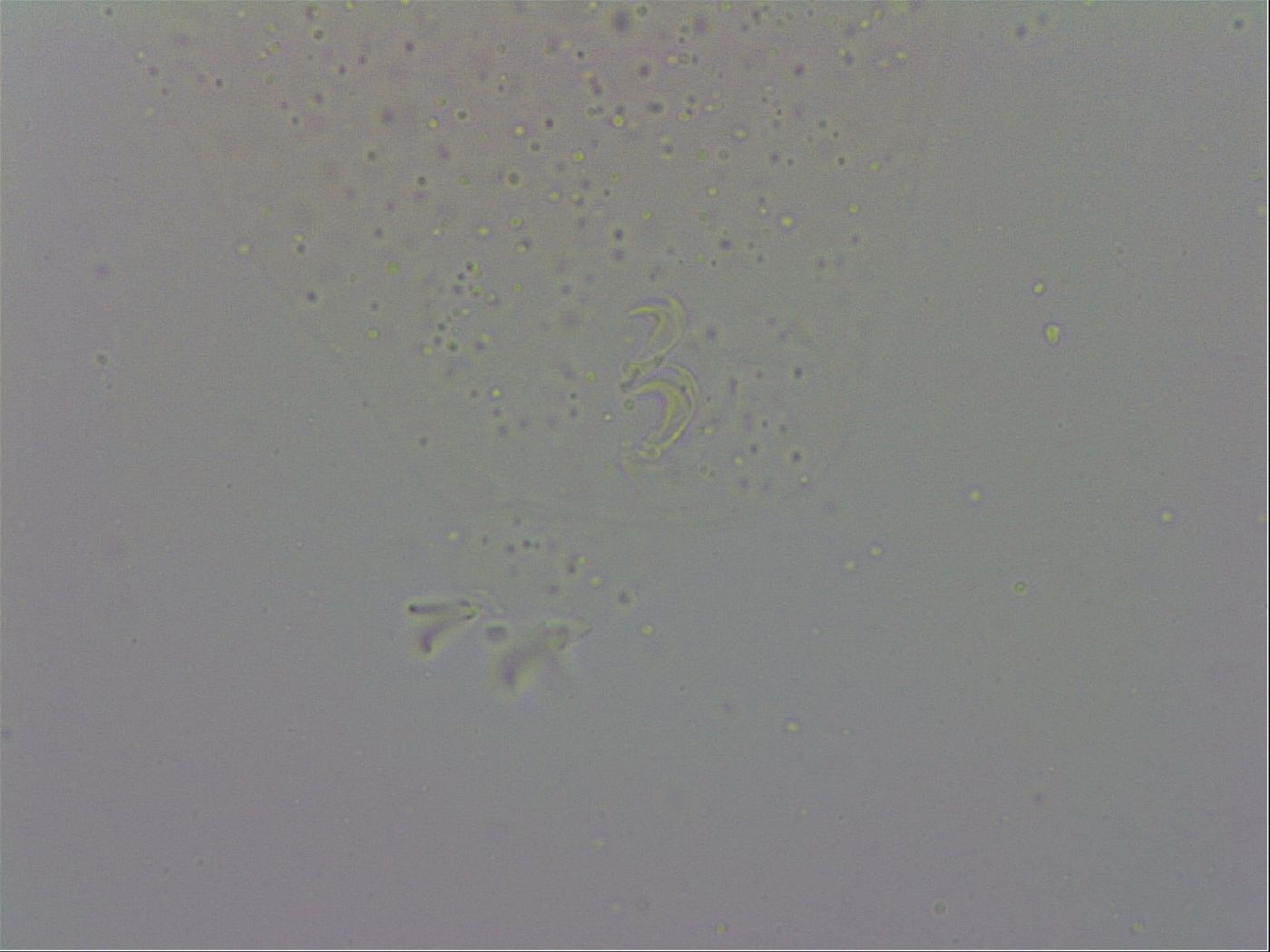 Macrobiotus hibiscus image