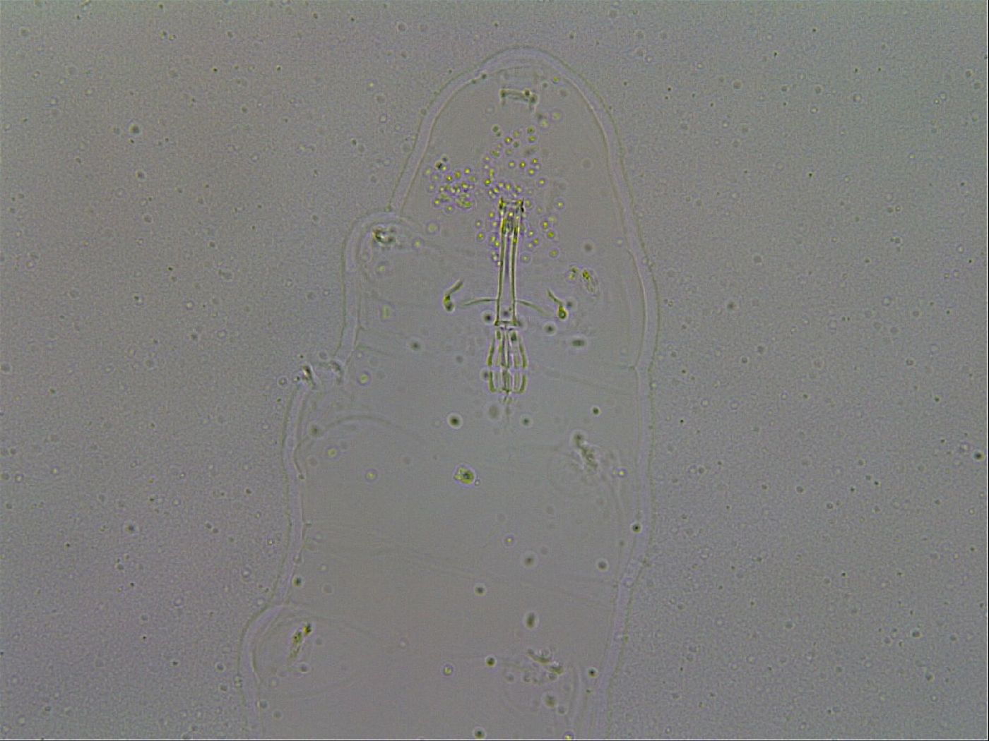 Macrobiotus hibiscus image