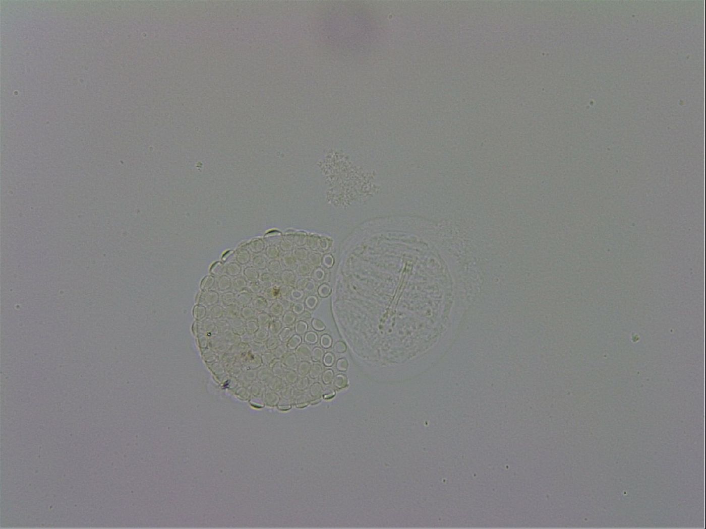 Mesobiotus montanus image