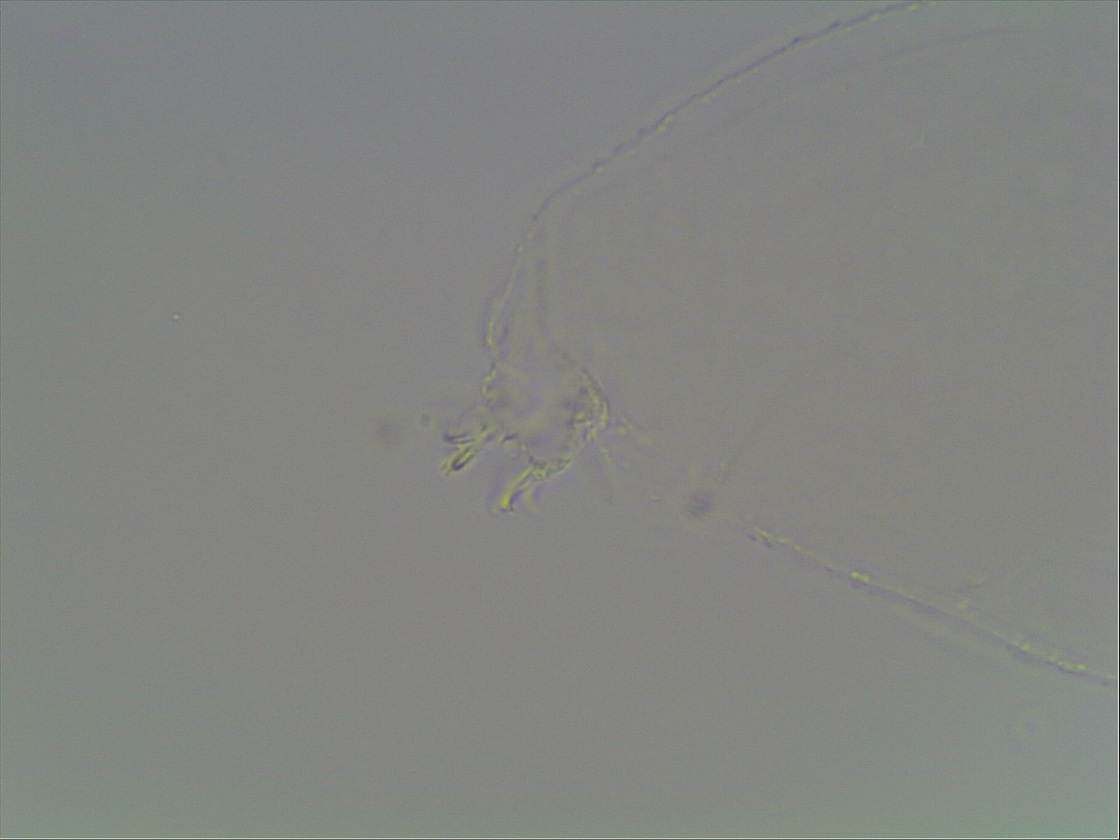 Mesobiotus montanus image