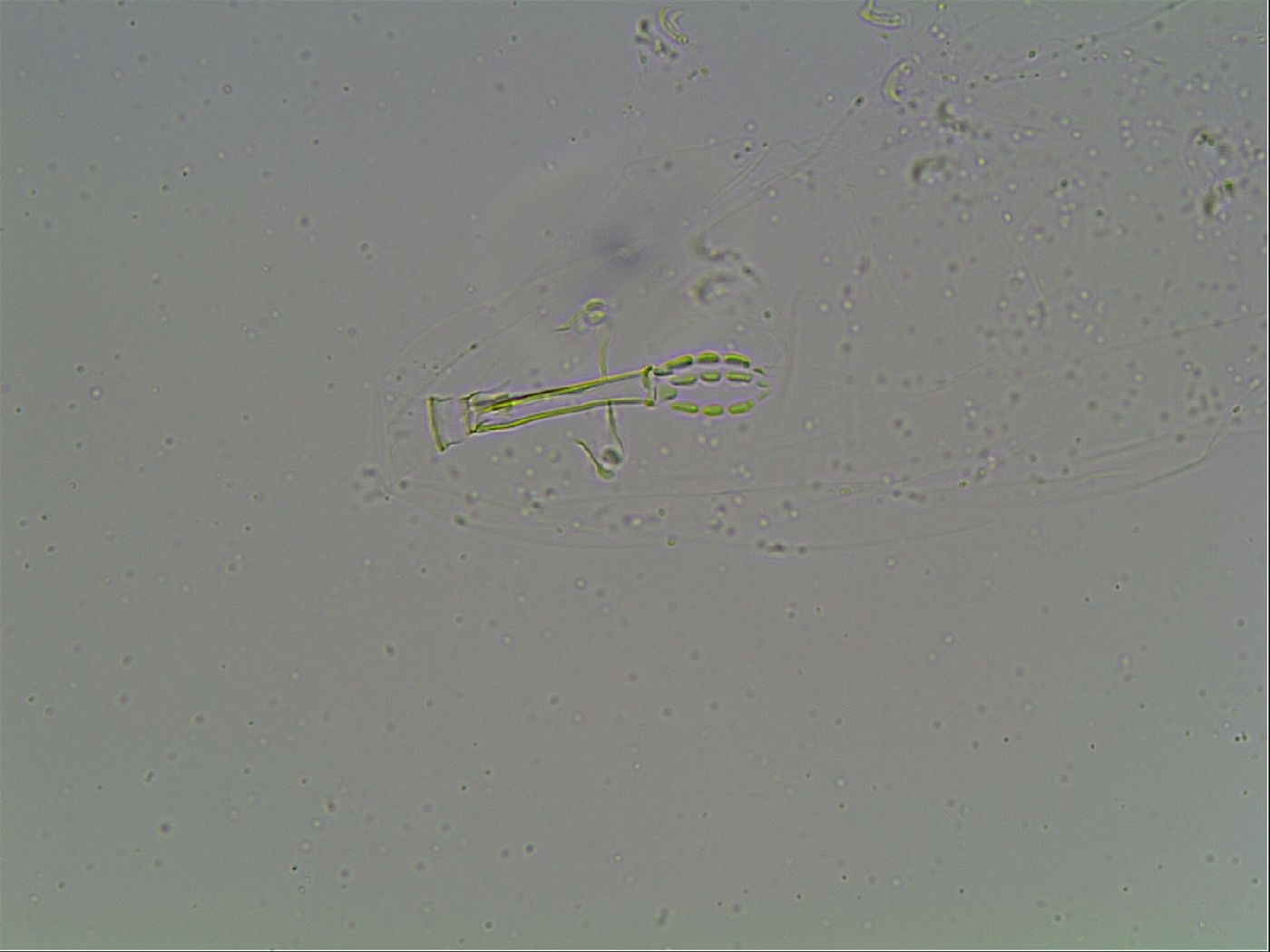 Mesobiotus montanus image