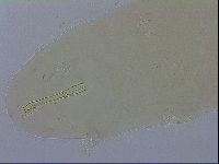 Image of Dactylobiotus macronyx