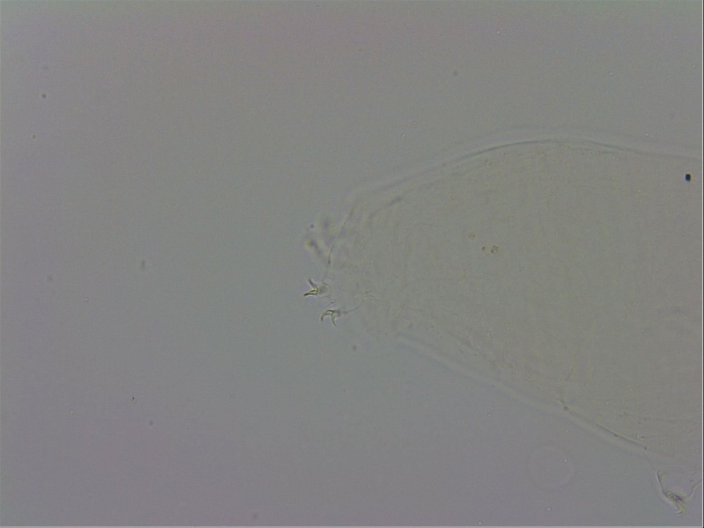 Mesobiotus orcadensis image