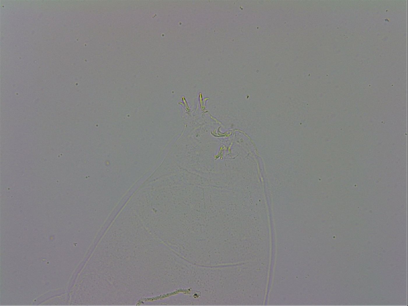 Mesobiotus orcadensis image