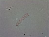 Mesobiotus polaris image