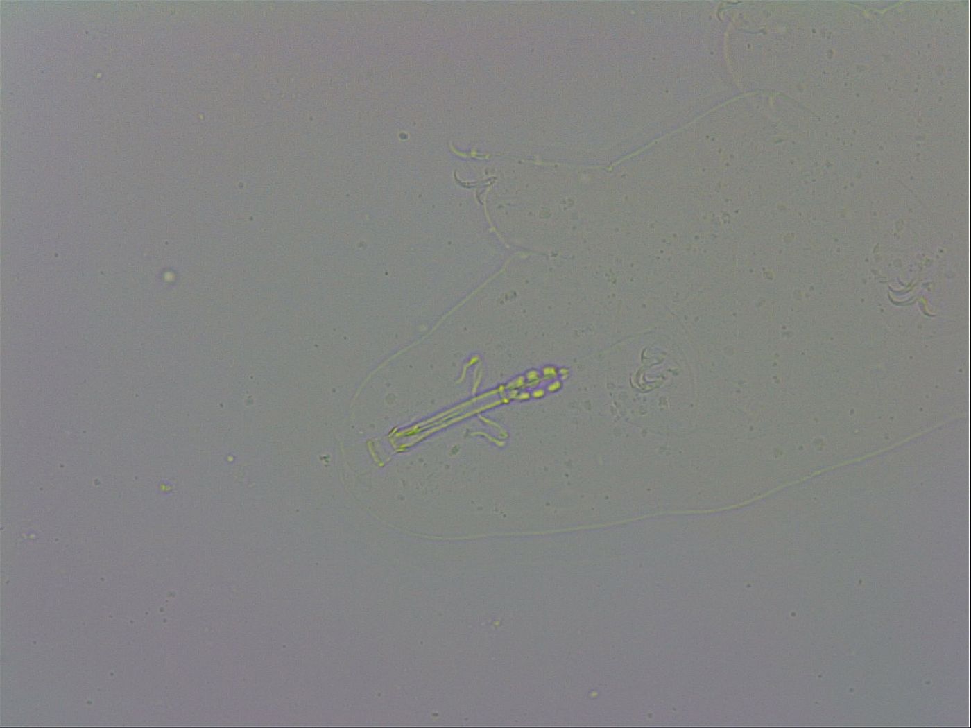 Mesobiotus polaris image