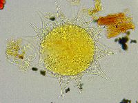 Mesobiotus liviae image