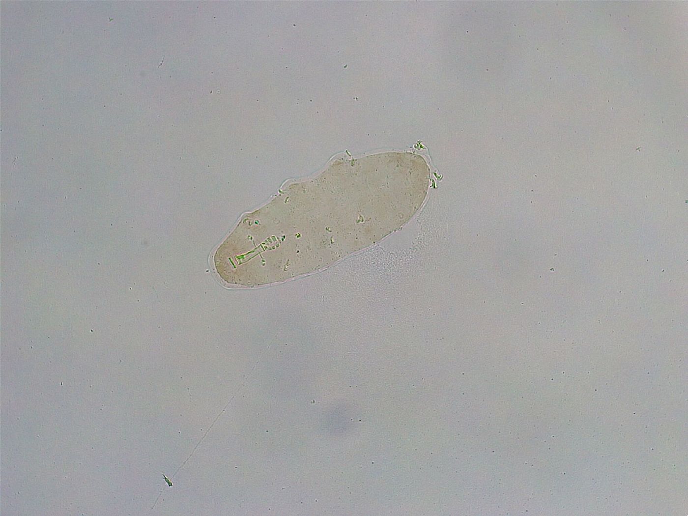 Mesobiotus liviae image