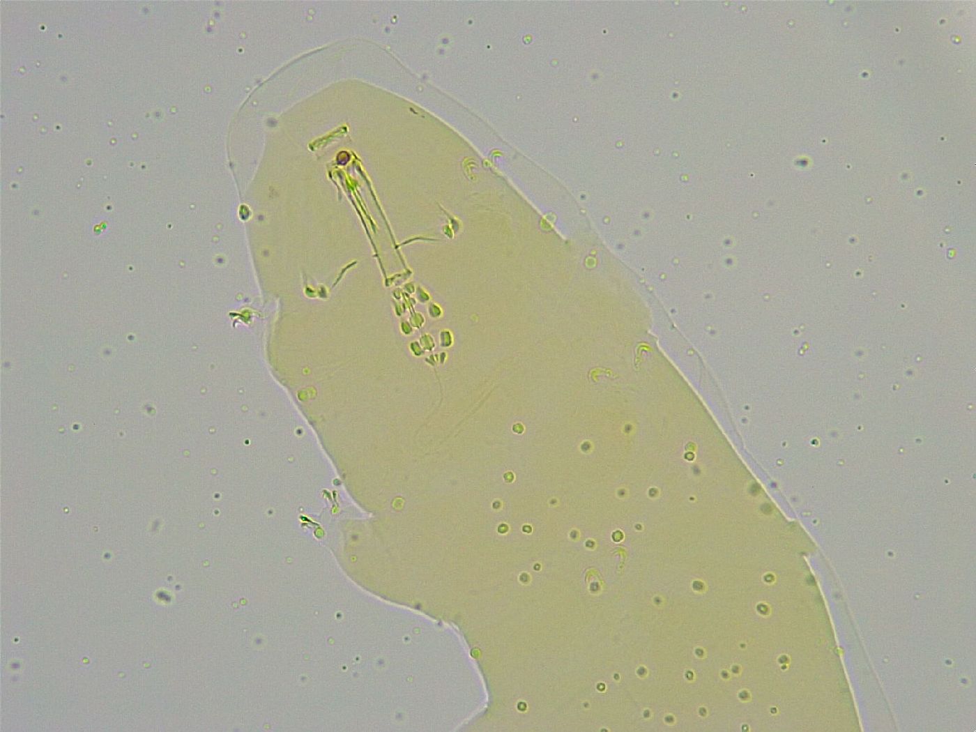 Mesobiotus liviae image