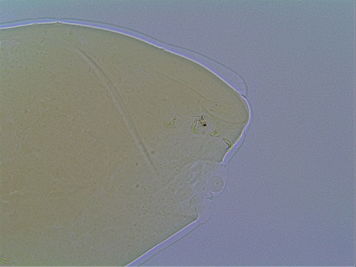 Mesobiotus liviae image