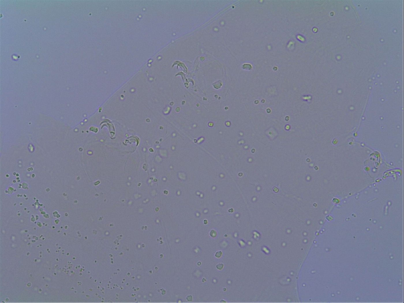 Mesobiotus snaresensis image
