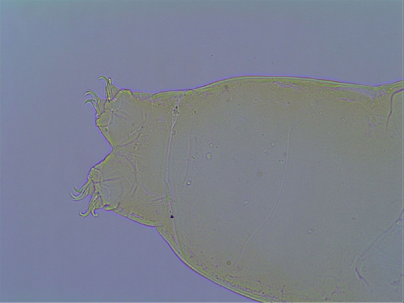 Macrobiotus islandicus islandicus image