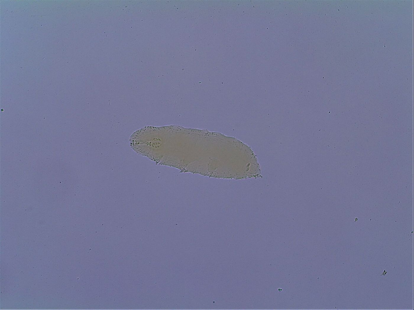 Mesobiotus coronatus image