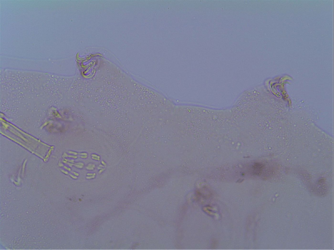 Mesobiotus snaresensis image