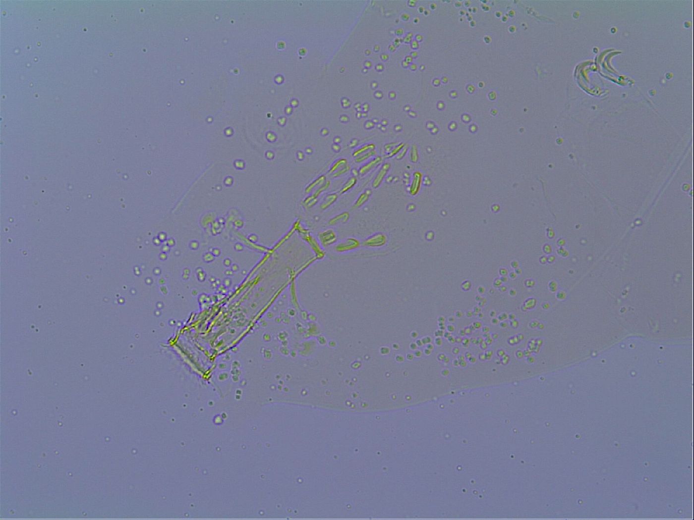 Mesobiotus snaresensis image