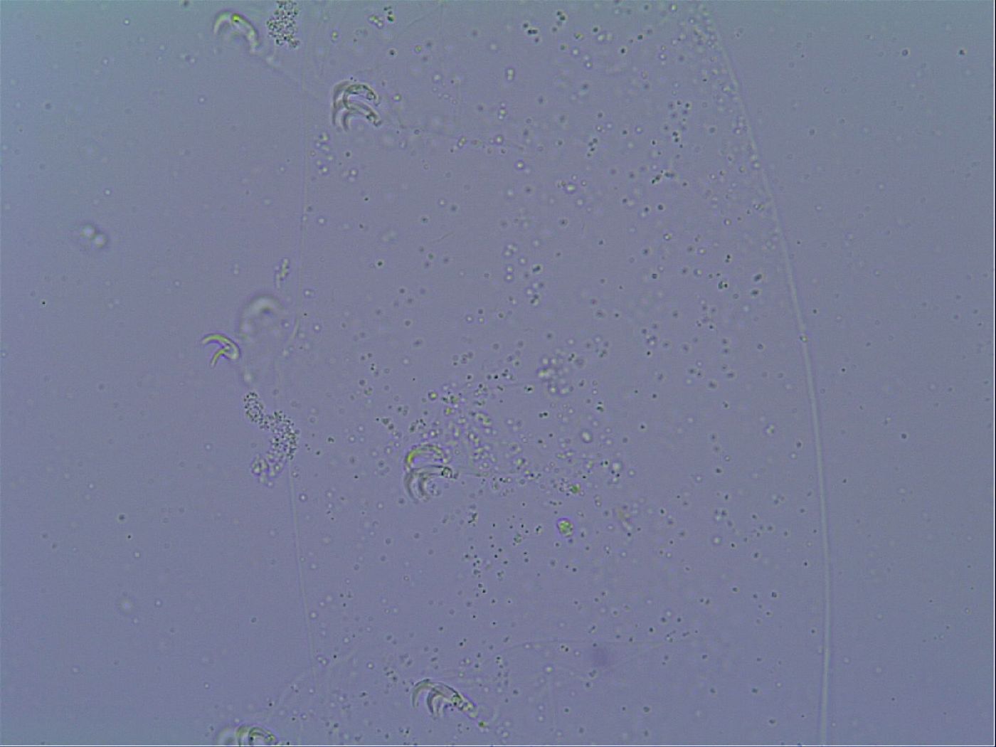 Mesobiotus snaresensis image