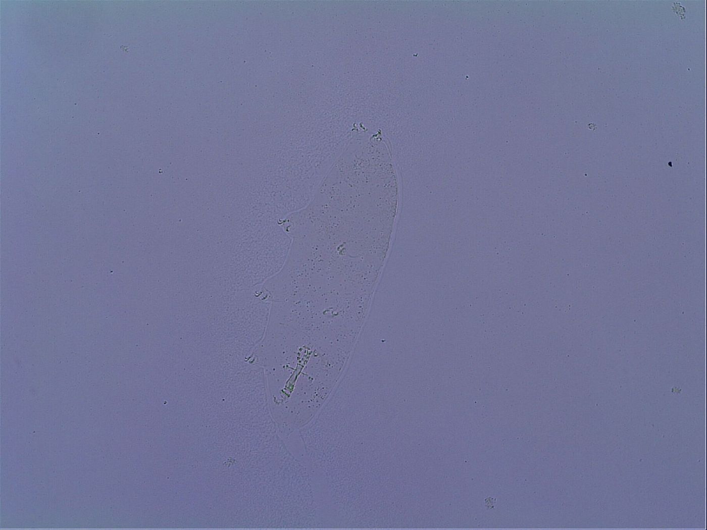 Mesobiotus snaresensis image