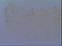 Mesobiotus snaresensis image