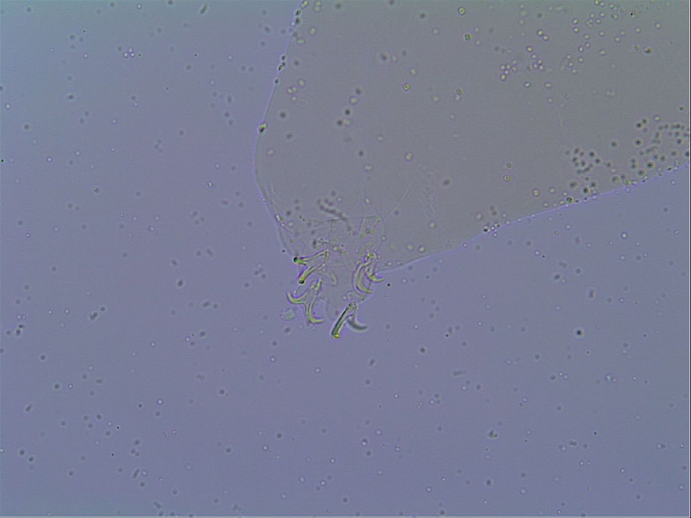 Mesobiotus snaresensis image