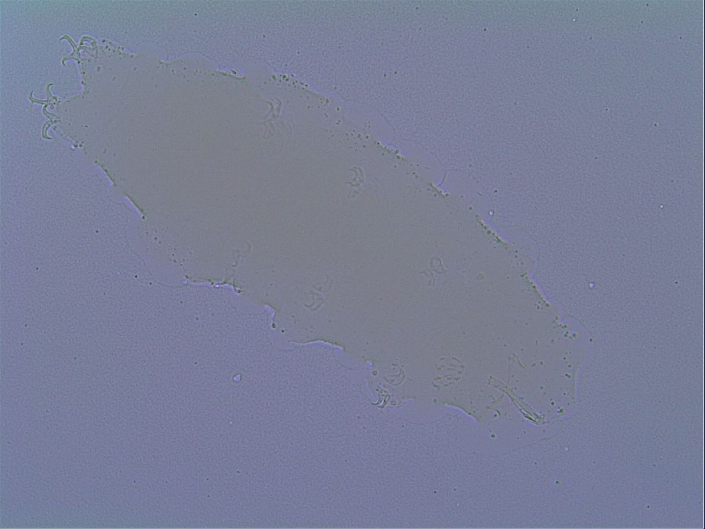 Doryphoribius zyxiglobus image