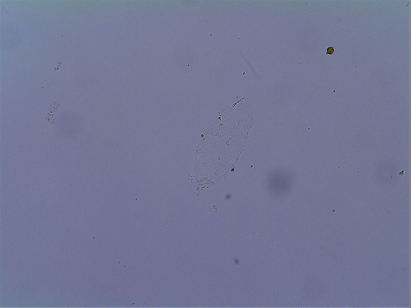 Doryphoribius zyxiglobus image