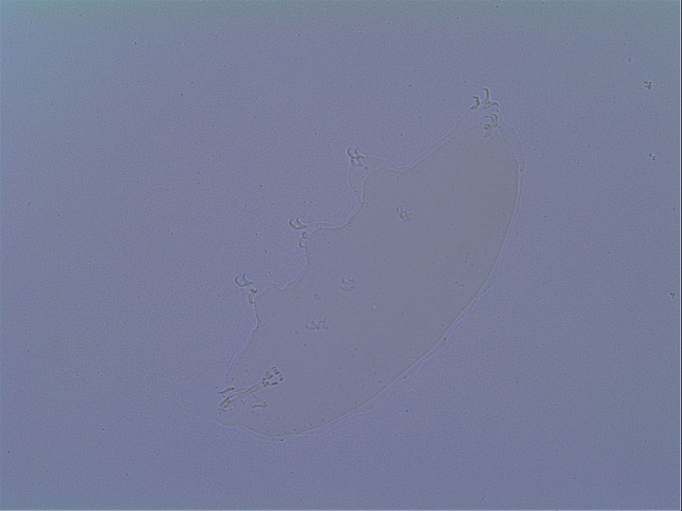Doryphoribius zyxiglobus image