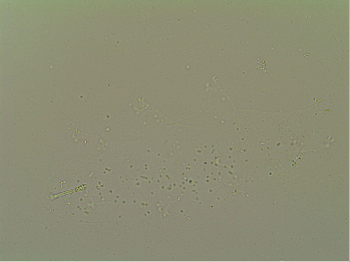 Macrobiotus topali image
