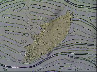 Milnesium tardigradum image