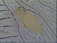 Milnesium tardigradum image