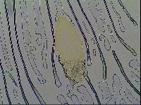 Milnesium tardigradum image