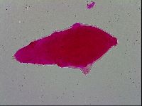 Milnesium tardigradum image