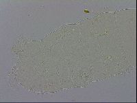 Milnesium tardigradum image