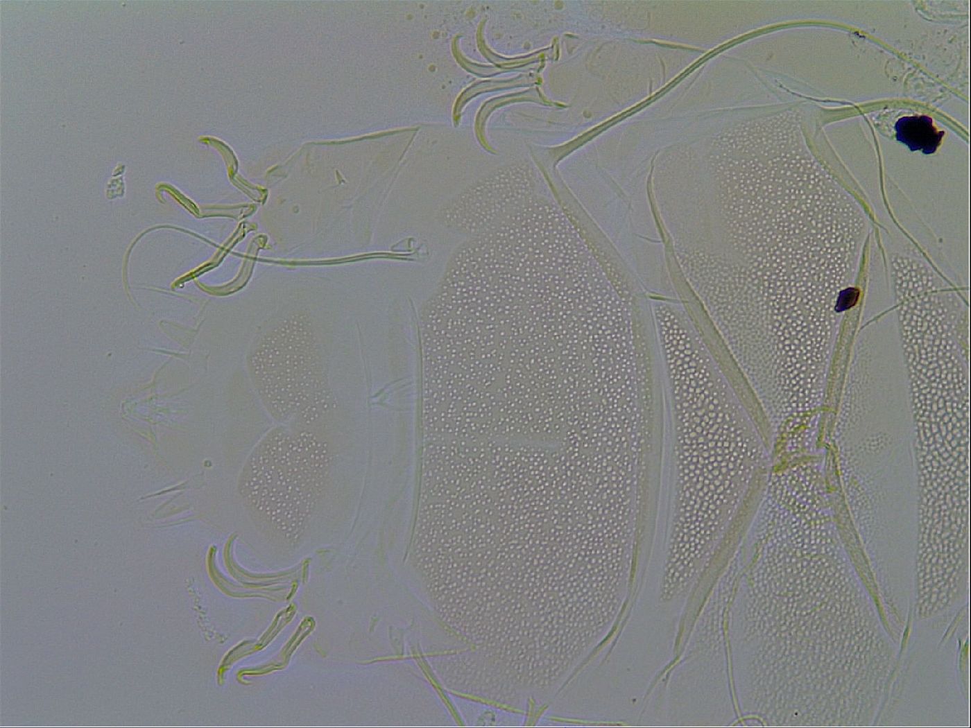 Echiniscus testudo image