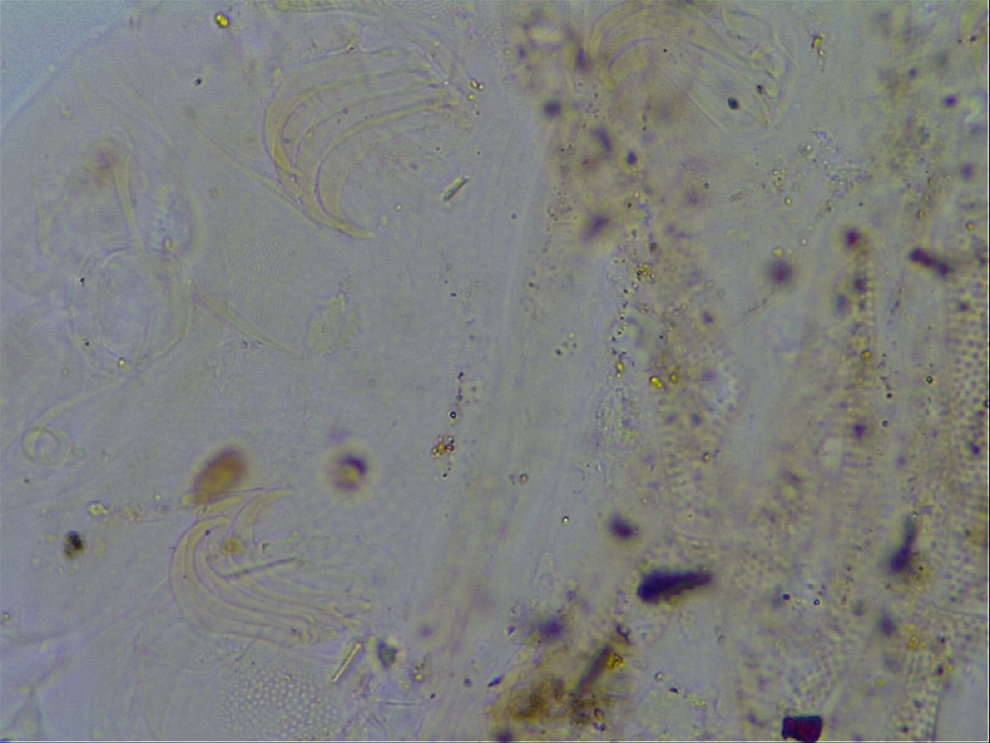 Echiniscus testudo image