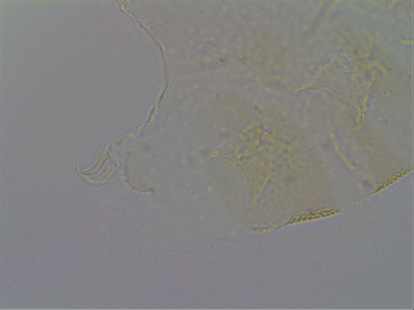 Echiniscus trisetosus image