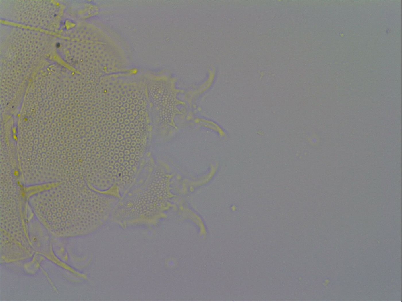 Echiniscus trisetosus image